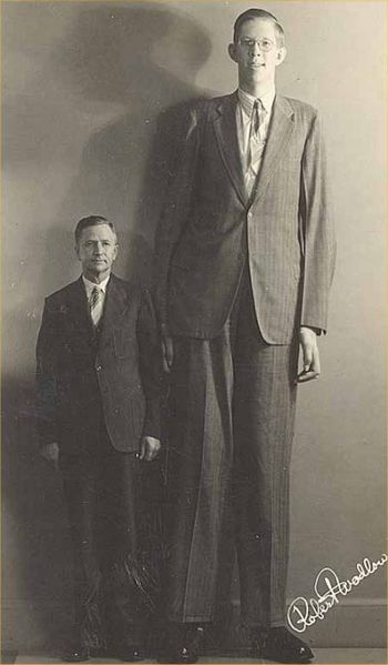 urias gigantism - robert wadlow